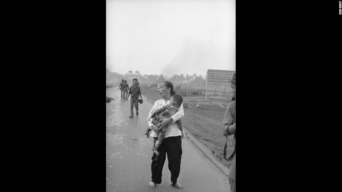 An anguished woman carries her napalm-burned child.