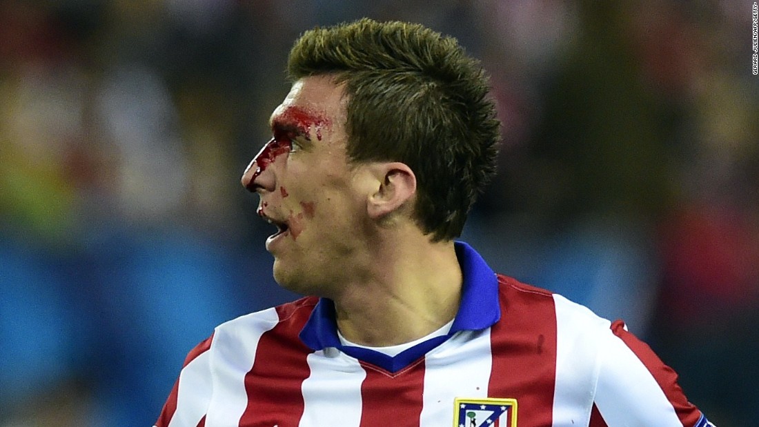 Mario Mandzukic was left with blood streaming from his face after a second half clash with Sergio Ramos.