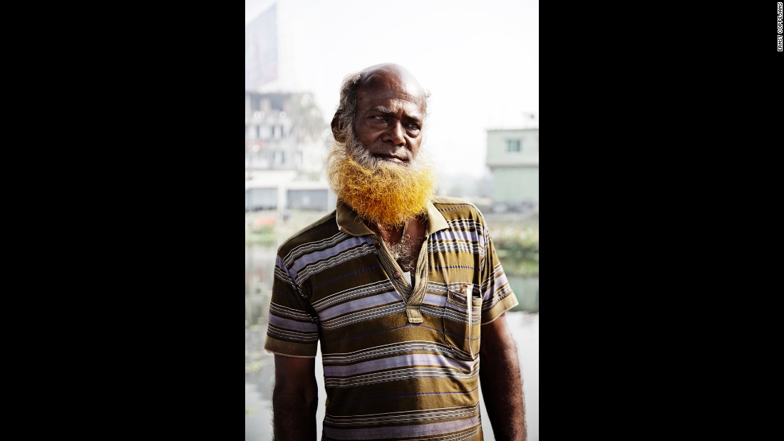 When he first arrived in Bangladesh, photographer Ernst Coppejans saw it everywhere: men who had dyed their hair or their facial hair orange.