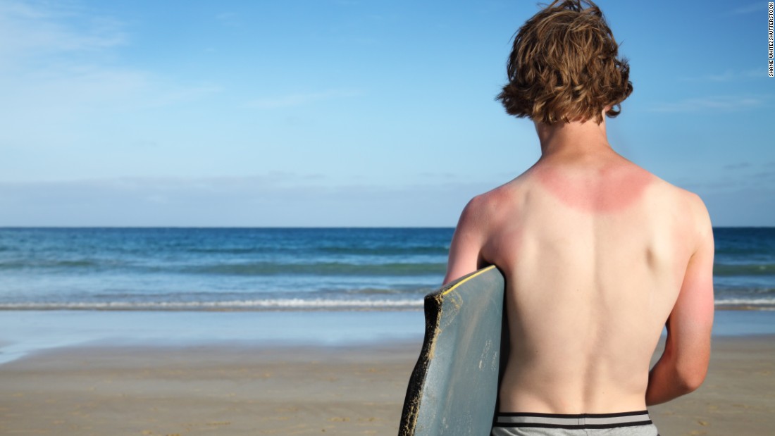 One key goal that research supports: avoid sunburns, no matter your age. Try to stay out of it during the hottest times of the day, usually 10 a.m. to 2 p.m., and wear protective clothing, a broad-brimmed hat and sunglasses. Behind the many joys of summer are hidden health hazards that threaten to slow you down. Click through our gallery to learn more about keeping yourself healthy.