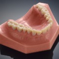 printed teeth