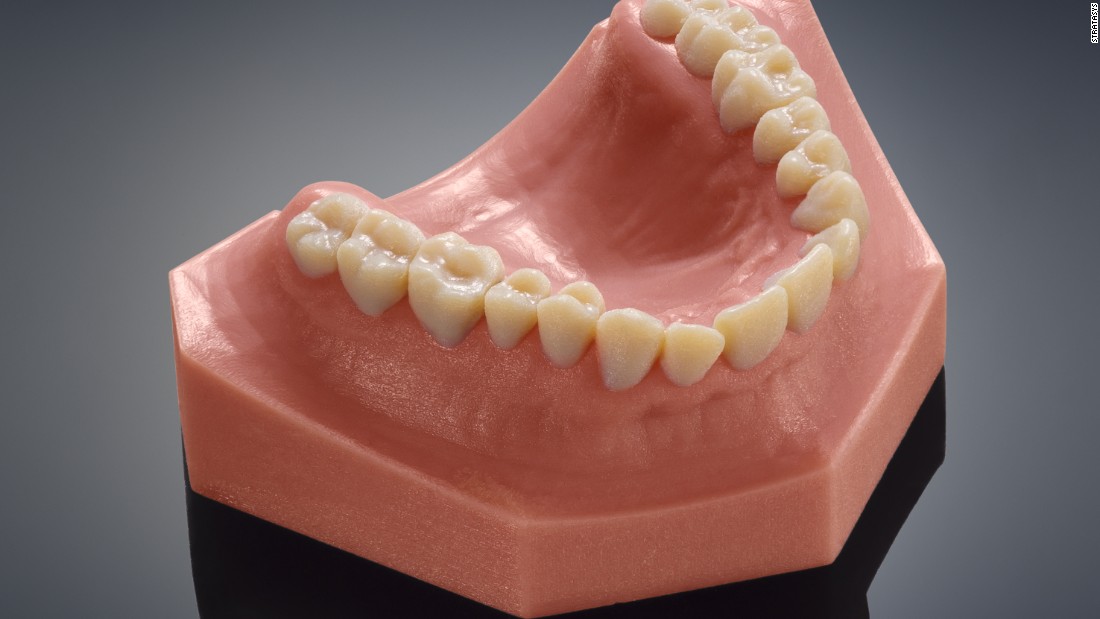 Printed horns will be followed by printed teeth for humans, as with this set from Stratasys. 