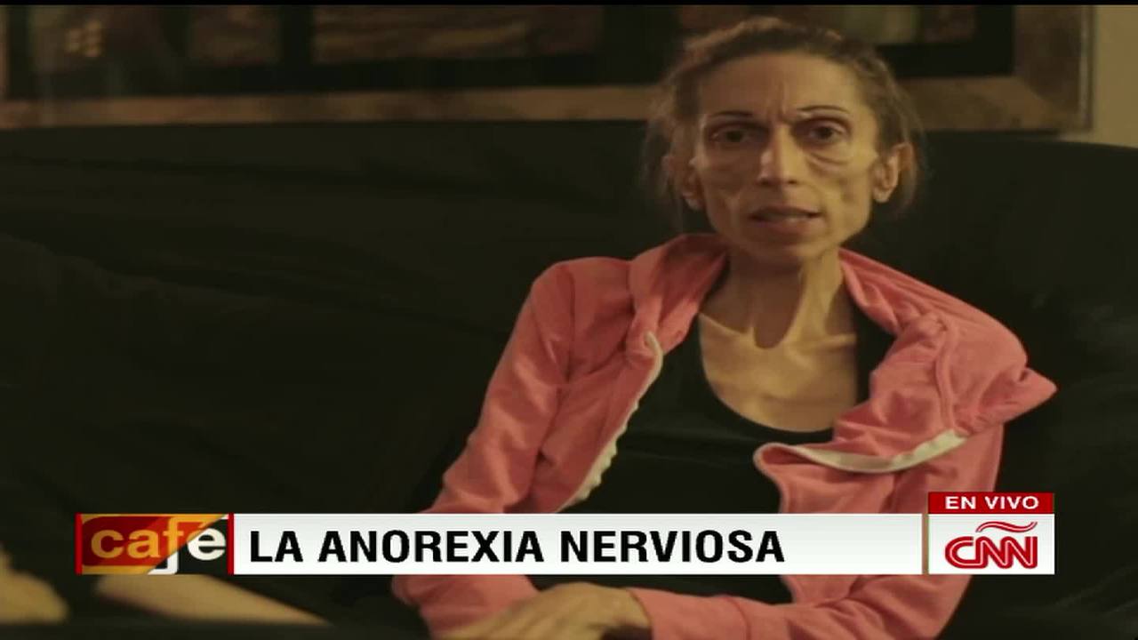 Qué es la anorexia nerviosa? - CNN Video