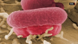 E. Coli Outbreaks Fast Facts - CNN