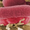 E. Coli Outbreaks Fast Facts - CNN