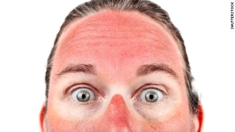 Hot mess: The grossest health concerns of summer 