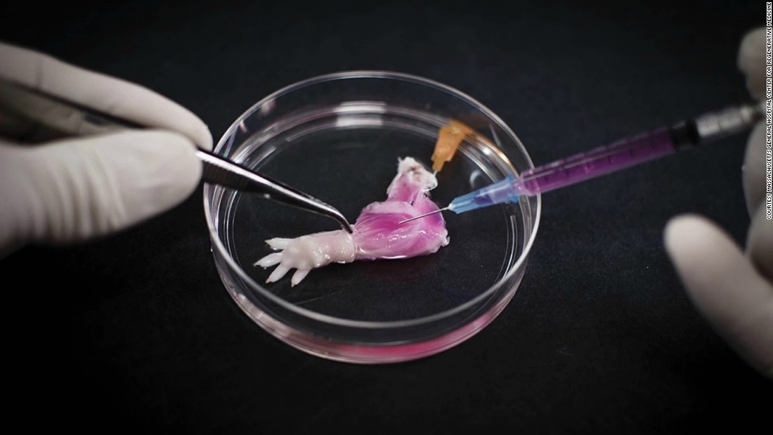 Harald Ott and his team at Massachusetts General Hospital recently regenerated the limb of a rat in the lab, by flushing the arm of all cells and then regrowing them with cells from a different rat.