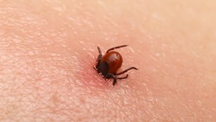 What you need to know about ticks