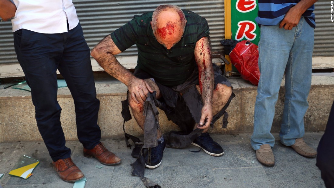 A wounded man waits for medical attention after the explosion.