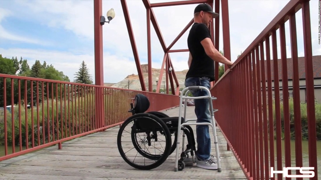 Breakthrough Paralyzed Patients Stand Cnn