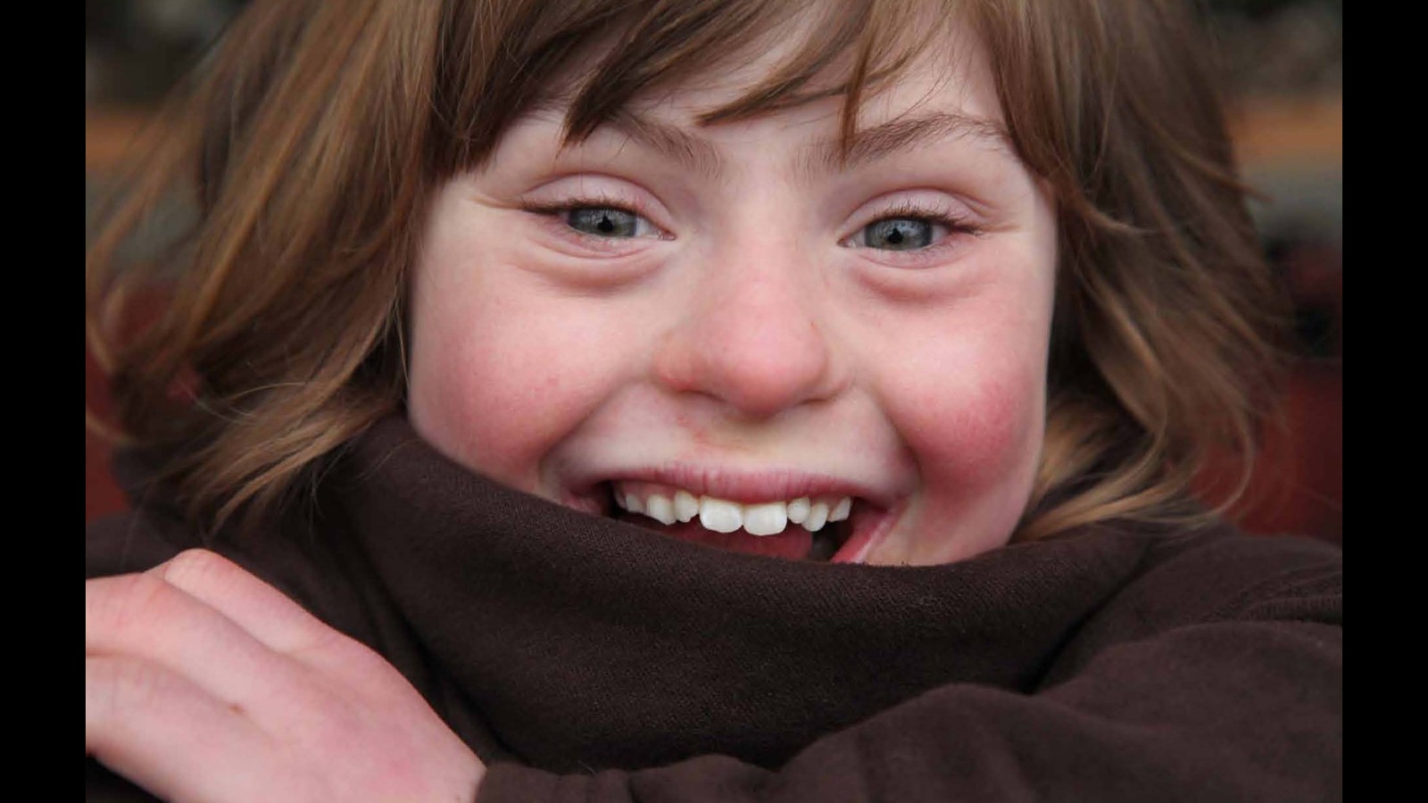 Ребенок с синдромом Дауна улыбается