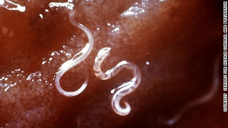 A type of hookworm, attached to the intestinal mucosa.