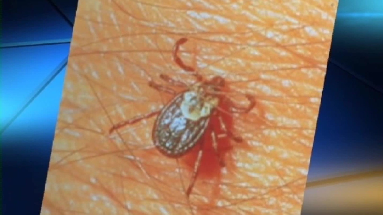 Exploding Tick Population And Illnesses They Bring Worries