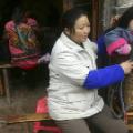 Girl with rickets Neijiang China