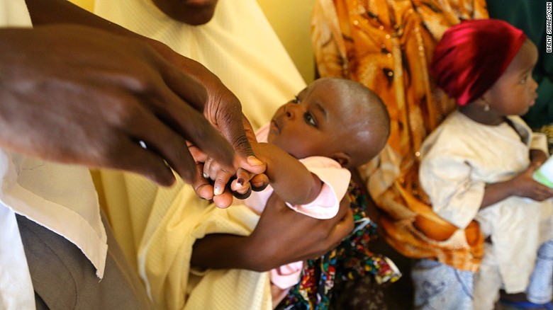 Nigerias Fight To Wipe Out Polio Cnn 4431