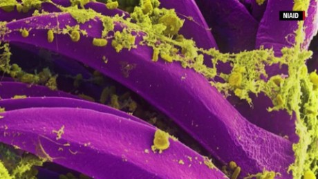 A New Mexico man has died from the state's second reported case of plague this year