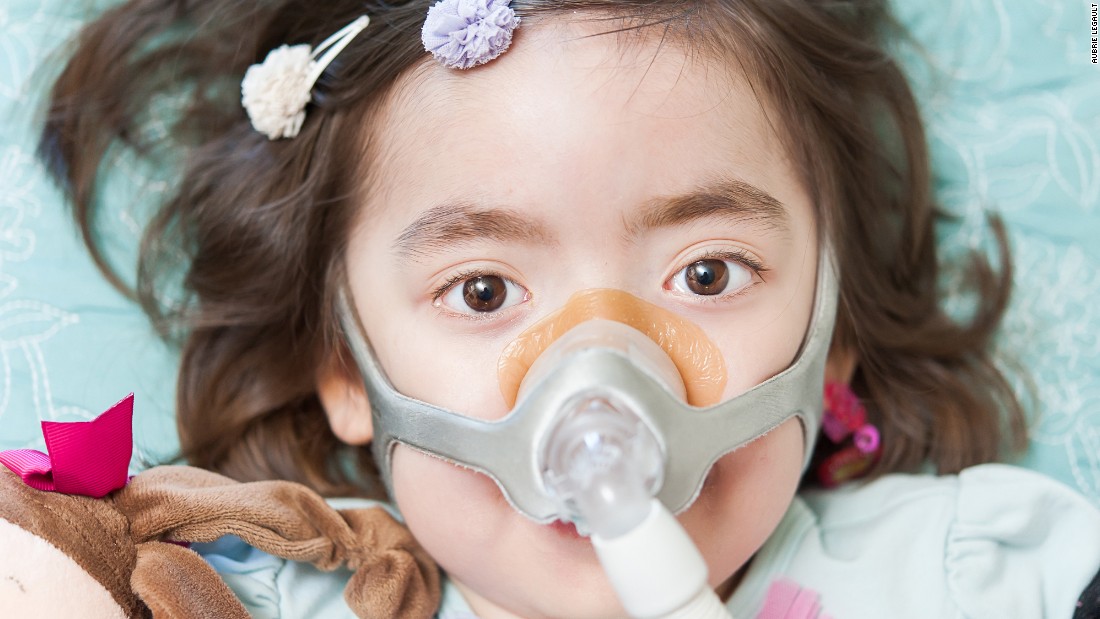 A pressurized mask pumps air into Julianna&#39;s lungs. An incurable neurodegnerative disease has attacked the nerves that control her muscles, including those that control her breathing.