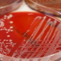 04 Gram-negative bacteria shutterstock