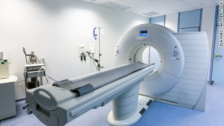 Coronary calcium screening better predicts heart disease risk, research finds