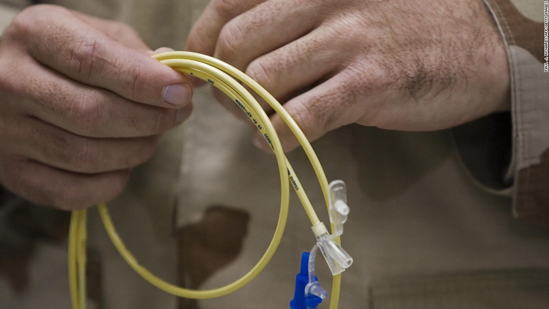 Hospital tubing, such as feeding tubes and central line tubes, can look a lot alike. In a survey, 16% of doctors and nurses said tube mix-ups happen at their hospitals. When you have tubes in you, ask the staff to trace every tube back to the point of origin so the right medicine goes to the right place. 