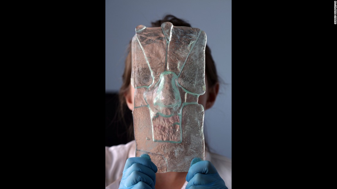 Researcher Claire Crowley holds up a glass mold of a patient&#39;s nose, which is used to create a new nose.