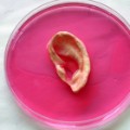 13 cnnphotos growing human body parts RESTRICTED