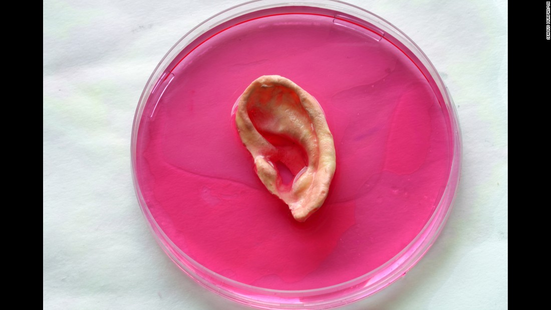 An ear mold in a cell solution.