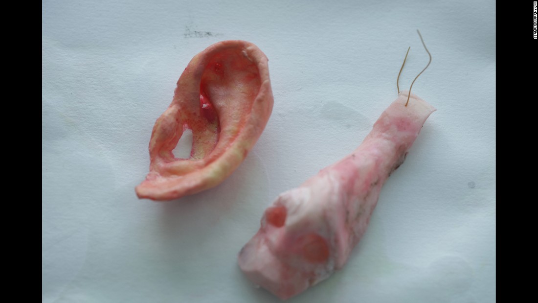 Nose and ear molds.