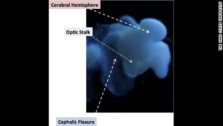 This lab-grown &quot;mini brain&quot; includes most characteristic of a human fetal brain including an optic stalk and a bend in the mid-brain region. (Click to expand.)