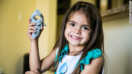 How a 3-D-printer changed a 4-year-old&#39;s heart and life