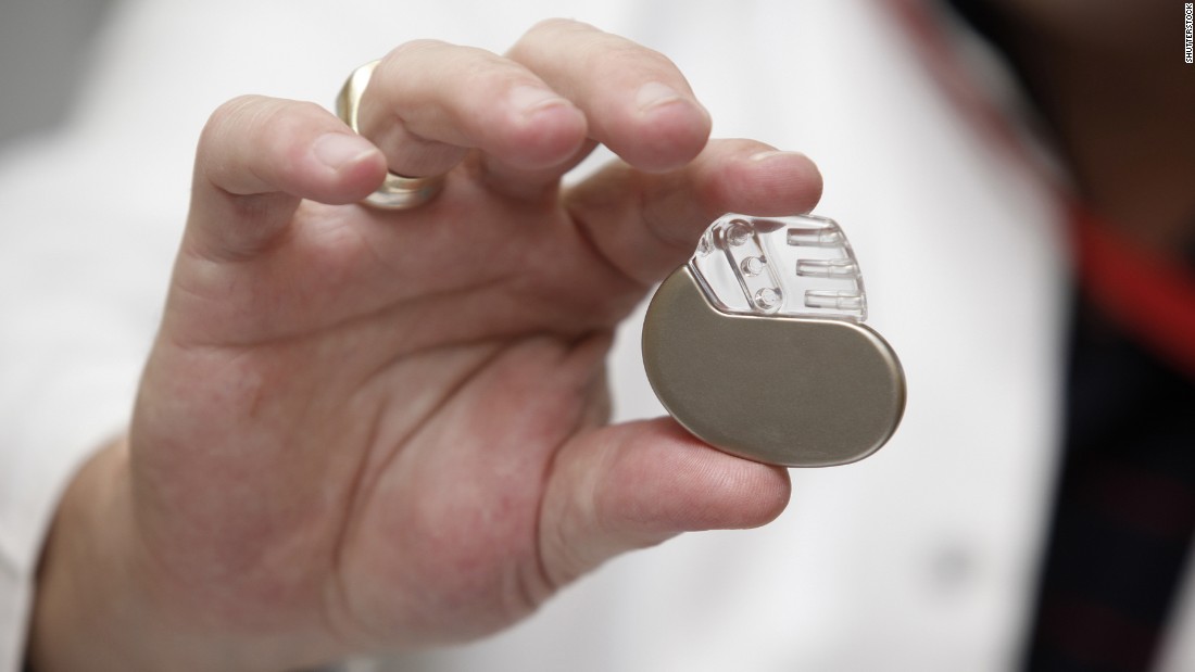 The first pacemakers were developed in the 1930s. They were large machines that were hand-cranked! Researchers worked on making smaller devices, and in 1958 the first human implanted device was created -- but it only lasted three hours. The pacemaker as we know it today wasn&#39;t achieved until the development of silicone transistors to improve the size of the machine, as well as the development of the long-life lithium battery. Today, pacemakers are about the size of a coin. 