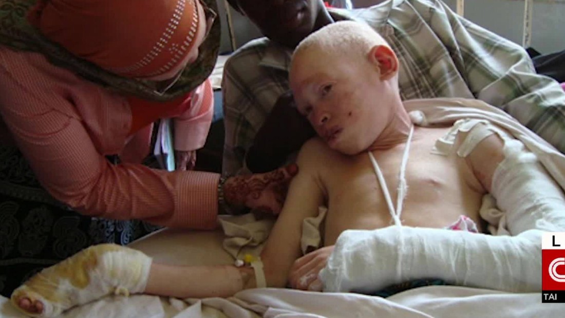 Albino Teen Attacked For Her Body Parts CNN Video