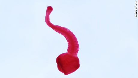 Tapeworms and four other disgusting parasites you should know
