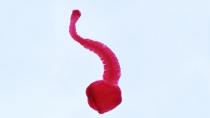 cnn tapeworm parasites alaskan