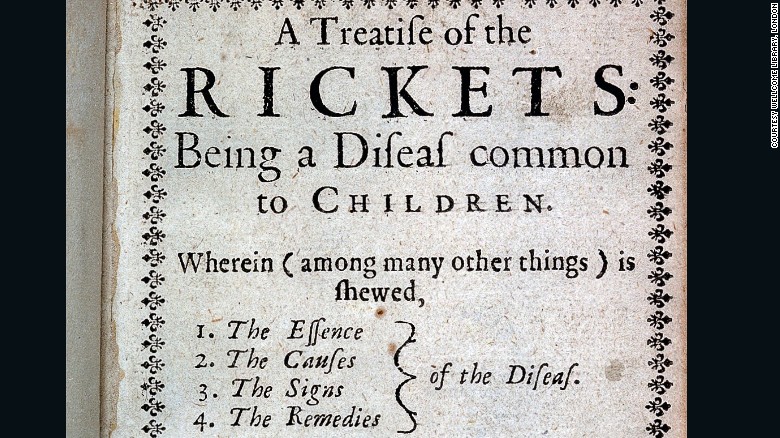 &quot;A treatise of the Rickets,&quot; published 1651.