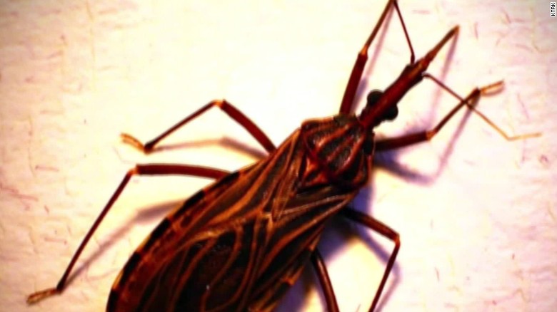 Kissing Bug Disease More Deadly Than Thought Cnn 7911