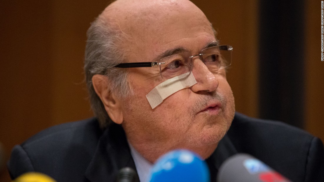 FIFA president Joseph S. Blatter during a press conference he convened in response to the ban imposed by FIFA&#39;s Ethics Committee. The Swiss was sporting a band aid under his right eye -- thought to be because of a recent mole removal.