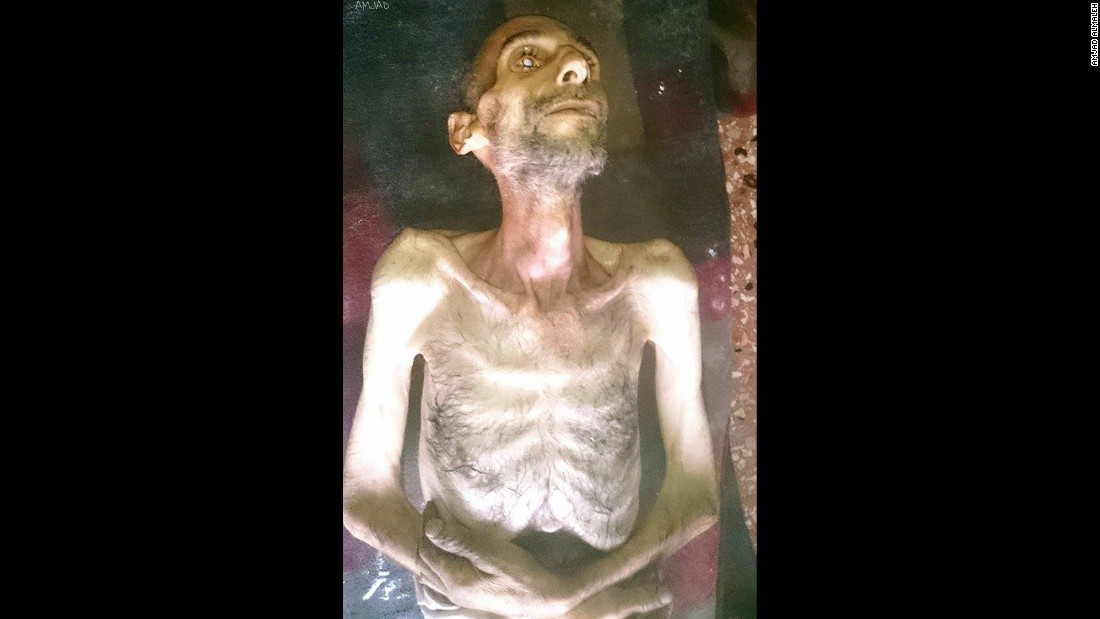 One activist in the Syrian town of Madaya posted this image on social media of Suleiman Abdul-Karim Fares, 40, who had died from starvation on January 4, 2016. CNN cannot independently verify the image or information.