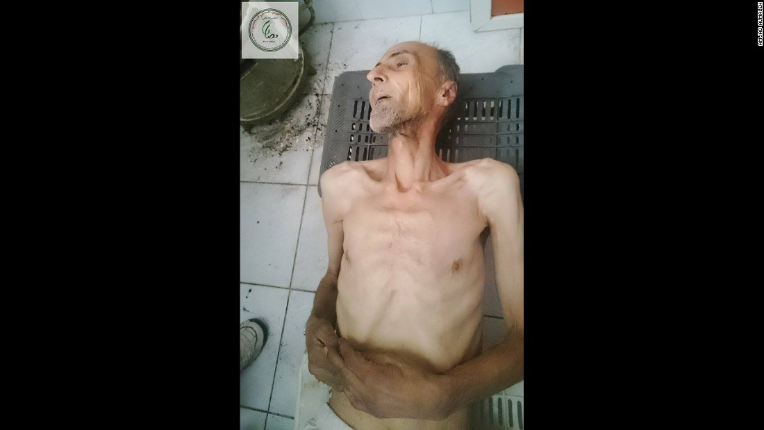 One activist in the Syrian town of Madaya posted this image on social media of Abdel Karim Jawad, 60, who had died on January 2, 2016 due to starvation and lack of access to medication. CNN cannot independently verify the image or information.