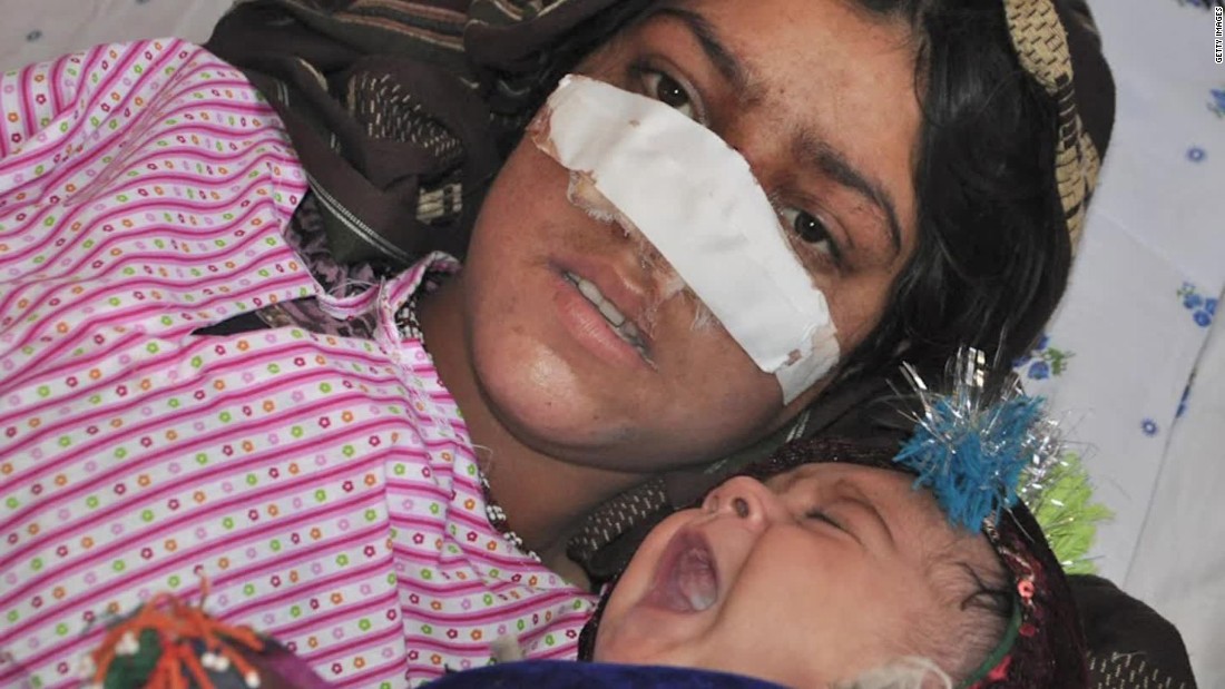 Afghan Womans Nose Cut Off By Husband Cnn Video