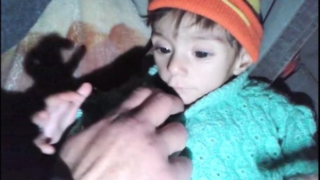 Disturbing scenes from Madaya, Syria