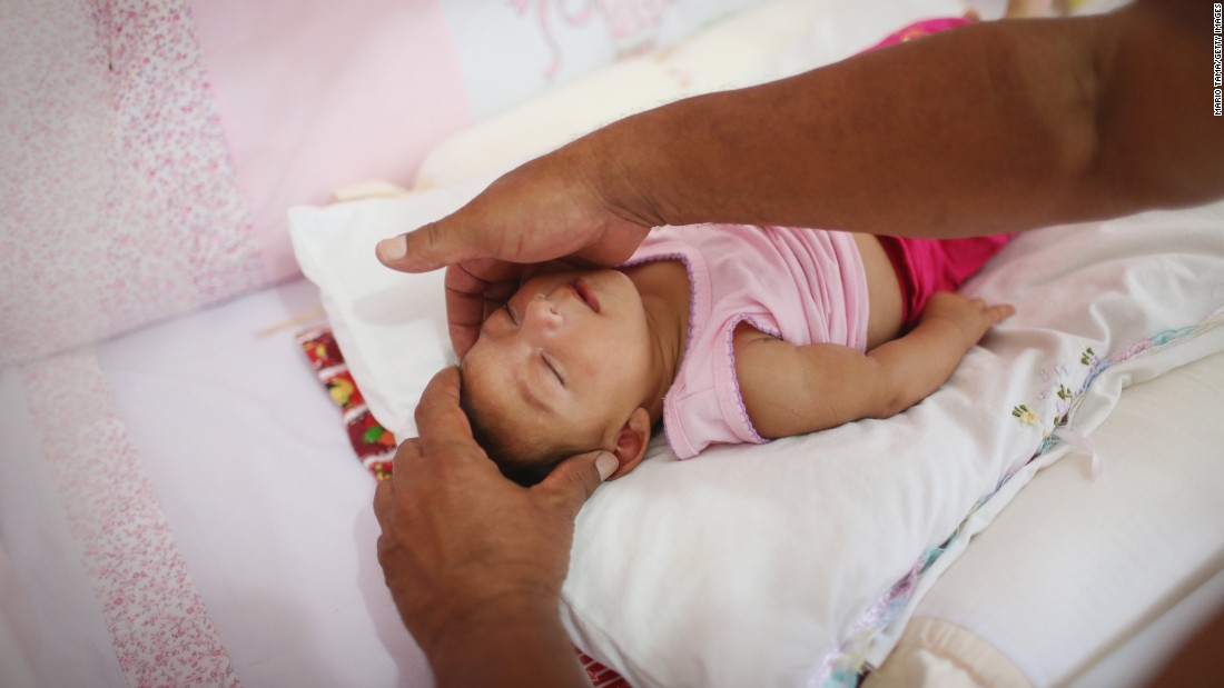 Alice Vitoria Gomes Bezerra, a 3-month-old baby with microcephaly, is placed in her crib by her father Wednesday, January 27, in Recife.