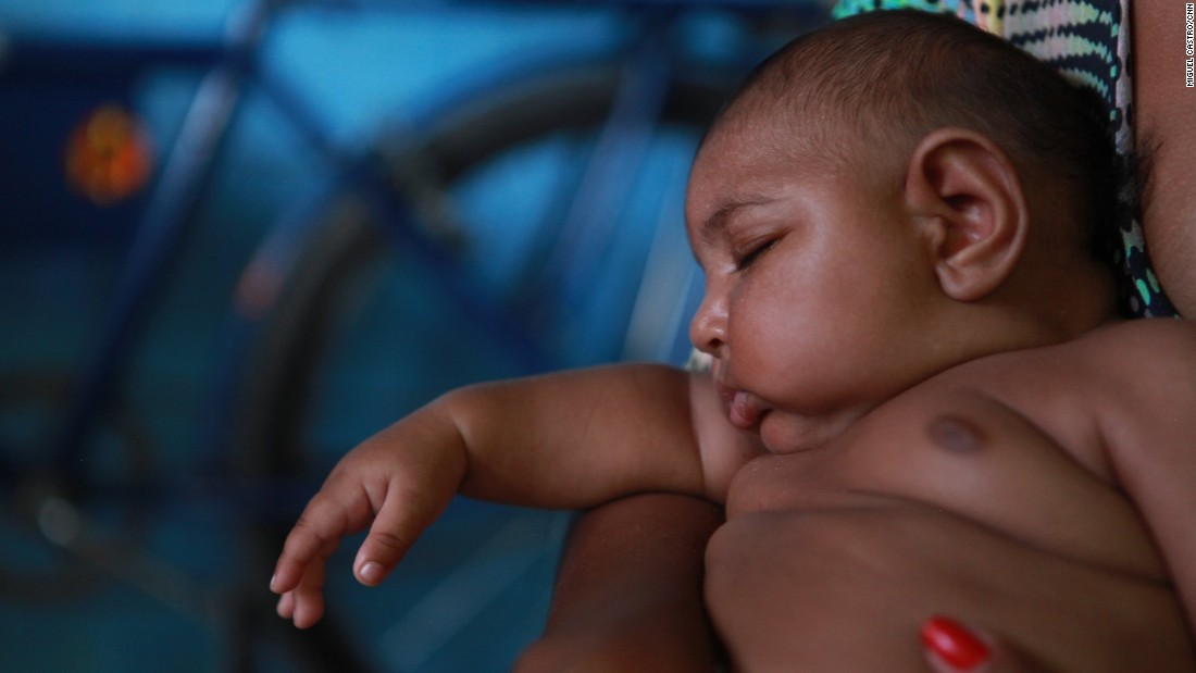 &lt;a href=&quot;http://www.cnn.com/2016/01/27/health/the-children-of-zika/index.html&quot; target=&quot;_blank&quot;&gt;Luiz Felipe&lt;/a&gt; lives in Recife and is one of more than 4,000 babies in Brazil born with microcephaly since October. The drought-stricken impoverished state of Pernambuco has been the hardest-hit, registering 33% of recent cases.