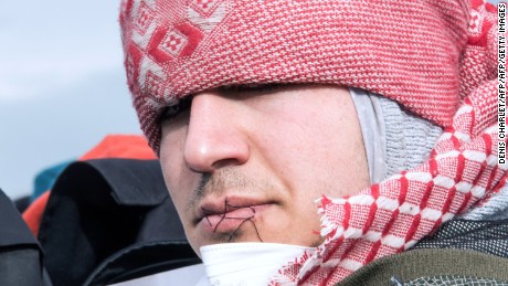 Migrants sew up their lips to protest &#39;Jungle&#39; demolition