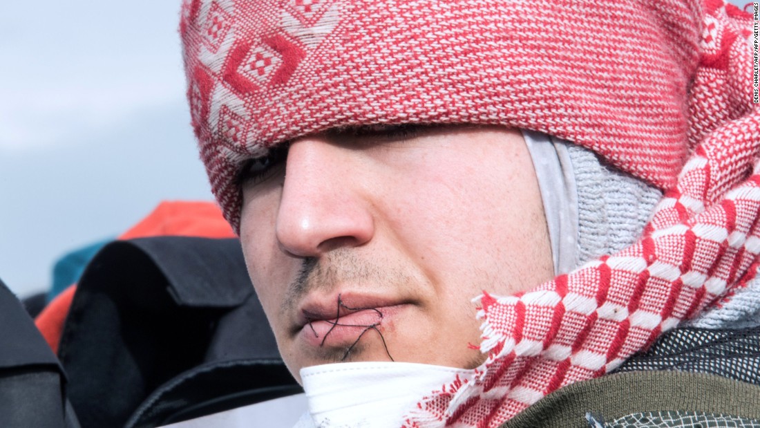 Migrants have sewn their lips together to protest again the demolition of part of the &quot;Jungle&quot; migrant camp in Calais, France.