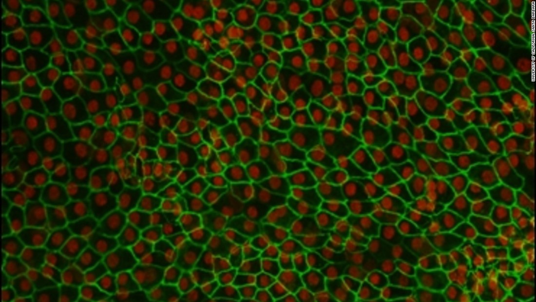 Cells in the eye&#39;s Retinal Pigmented Epithelium (REP) support the eye&#39;s vision center, the macula. Damage to these cells leads to deterioration of the macula, resulting in AMD. Pictured, retinal pigment epithelium (RPE) cells derived from human embryonic stem cells. 