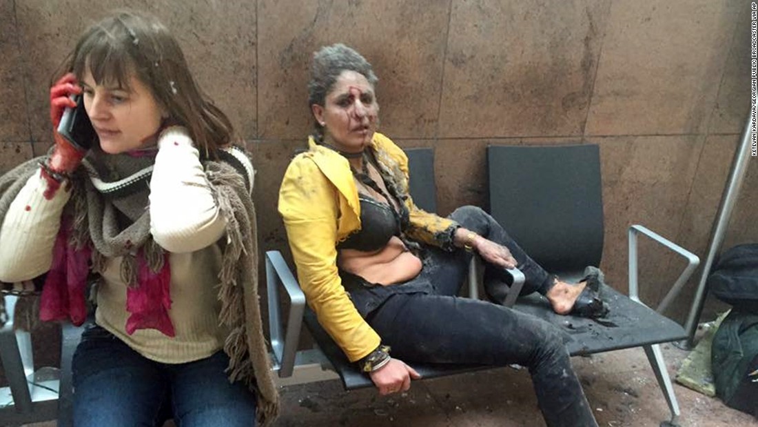 Two wounded women are seen in the airport.