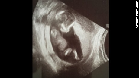 An earlier ultrasound of the Mehta&#39;s unborn child.