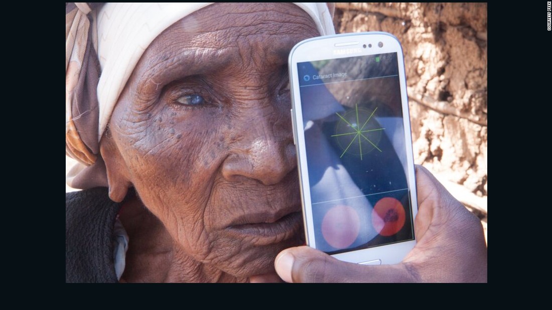 There are 39 million blind people in the world, and in low-income countries, 80% of blindness is curable, notes Dr. Andrew Bastawrous, an eye surgeon that helped develop the app.