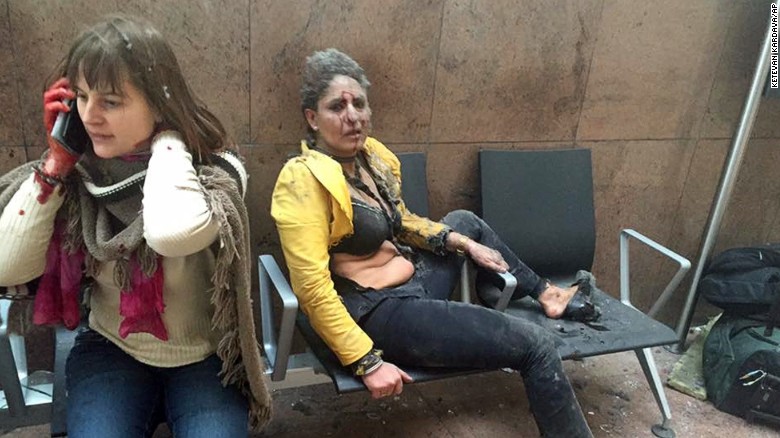 Nidhi Chaphekar, right, a 40-year-old Jet Airways flight attendant from Mumbai, and another unidentified woman after being wounded in Brussels Airport in Brussels, Belgium, after explosions were heard. The Indian flight attendant who was injured in the Brussels airport blasts is in stable condition and recovering, her airline Jet Airways said Friday, March 25, 2016. Chaphekar suffered burns and fractured her foot in the explosions on Tuesday. She has been treated at a hospital near Brussels. 